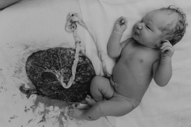 Nascita Lotus birth, il cordone non si recide, placenta e neonato restano legati fino al naturale distacco cordone neonato © instagram/senhoritasfotografia